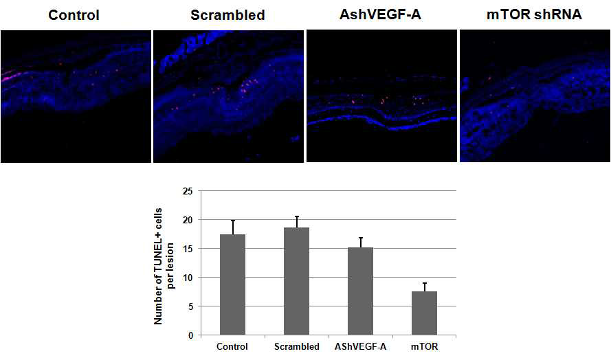 AAV-mTORshRNA와 AAV-AShVEGF-A 안구내 주사 후 TUNEL (+) 세포의 수의 변화 비교