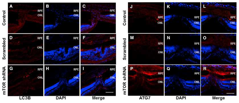 AAV-mTORshRNA 투여 후 맥락막신생혈관 조직에서 autophagy 활성화