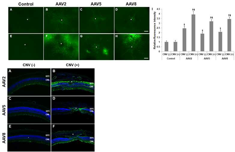 맥락막신생혈관 동물모델에서 다양한 혈청형을 가진 AAV-eGFP (AAV2, AAV5, AAV8, AAV9 )