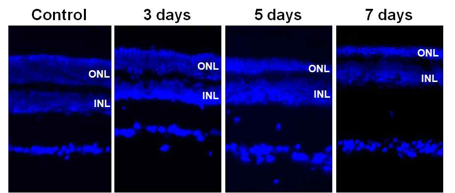 MNU-induced retinal degeneration model 확립