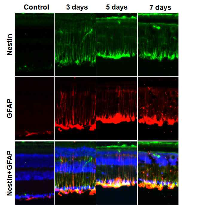 MNU-induced retinal degeneration model에서 광수용체세포의 사멸화에 따른 hypergliosis 현상의 시간에 따른 변화