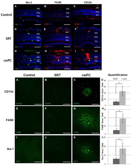 SRT에 의한 선택적 RPE cell death와 continuous wave laser treatment에 의한 neuroinlflammation의 양상 비교