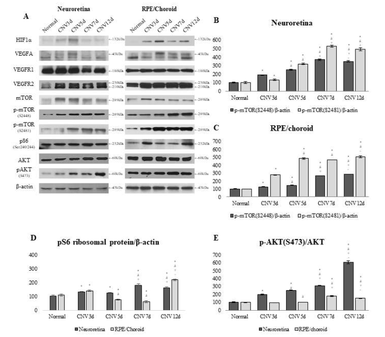 CNV 생성 과정에서 mTORC1 과 mTORC2 경로의 활성화 및 HIF1α/VEGF/VEGFR2 pathway 활성화의 시기별 비교