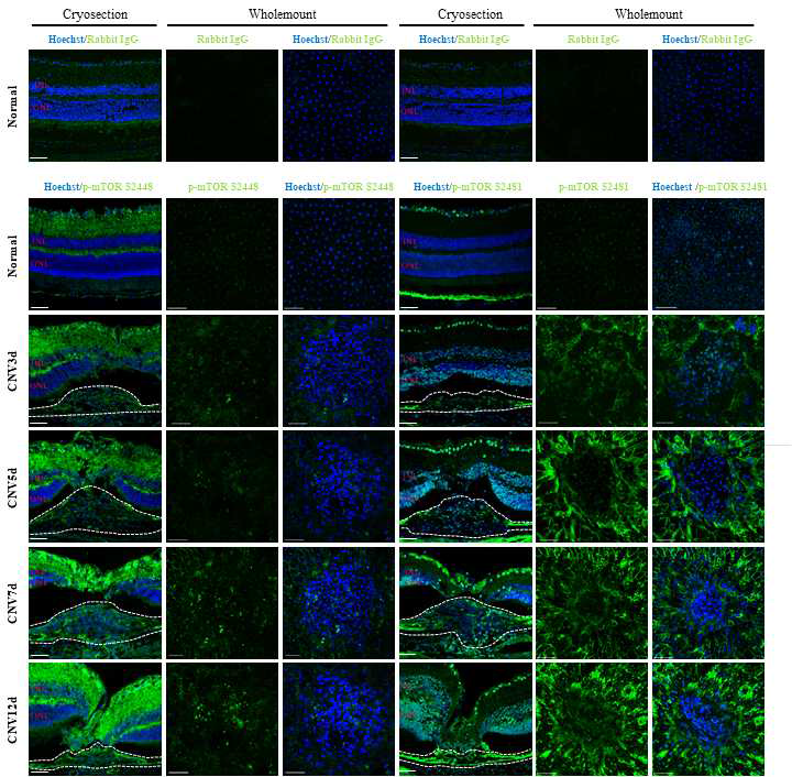 형광면역염색을 통한 맥락막신생혈관(CNV)에서 p-mTOR(S2448) 와 p-mTOR(S2481) 의 발현 위치 및 시기멸 활성 비교