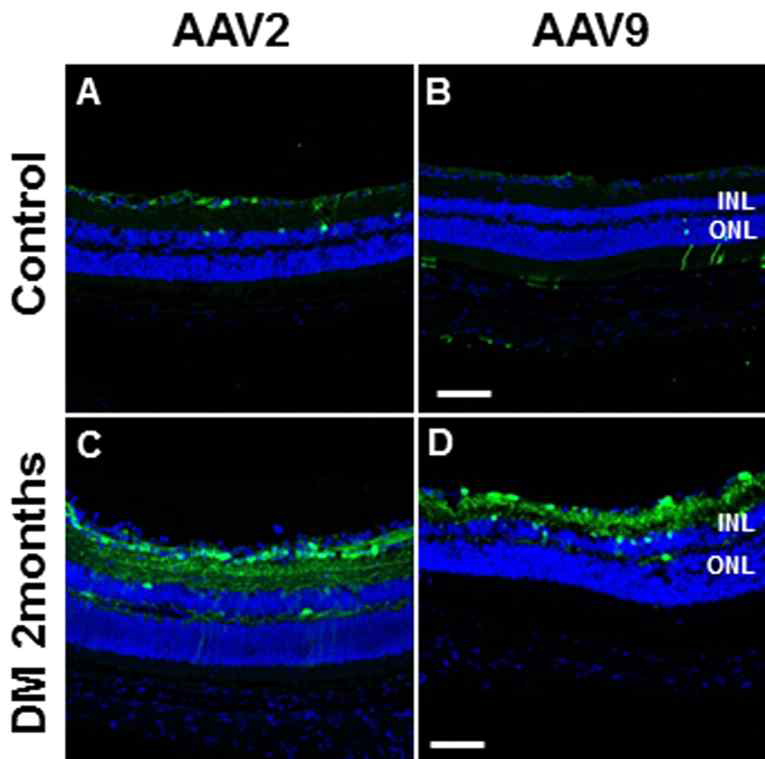 AAV2와 AAV9을 주사한 2달 당뇨망막병증 모델의 retina section에서 eGFP 발현 위치 확인