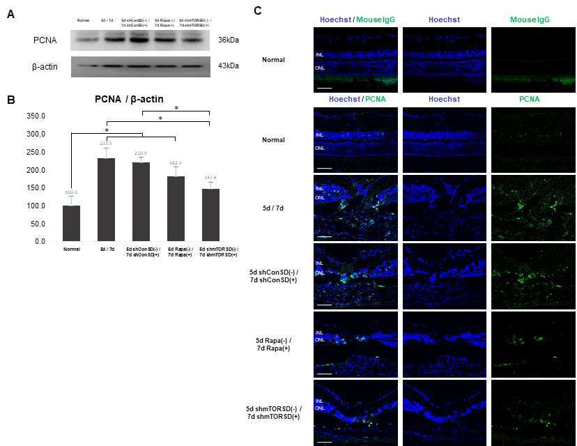 CNV 모델에서 세포증식마커인 PCNA (proliferating cell nuclear antigen) 발현에 AAV2-mTORshRNA-SD 와 rapamycin 의 투여로 인한 억제 효과