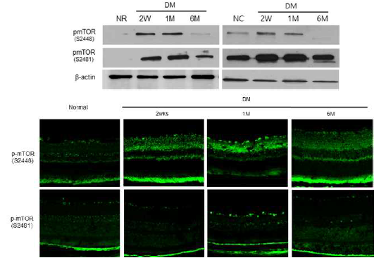 Streptozotocin 으로 유도된 당뇨병성 망막병증 (diabetic retinopathy) 모델에서 mTORC1 과 mTORC2 시기별 발현 비교