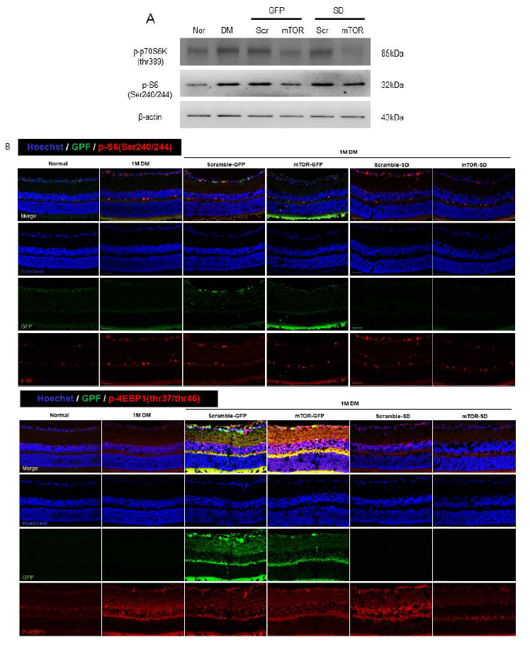 STZ로 유도된 당뇨병성 망막병증에서 mTOR 경로의 억제가 mTORC1 effector 발현에 미치는 변화 확인