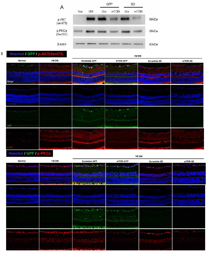 STZ로 유도된 당뇨병성 망막병증에서 mTOR 경로의 억제가 mTORC2 effector 의 발현에 미치는 변화 확인