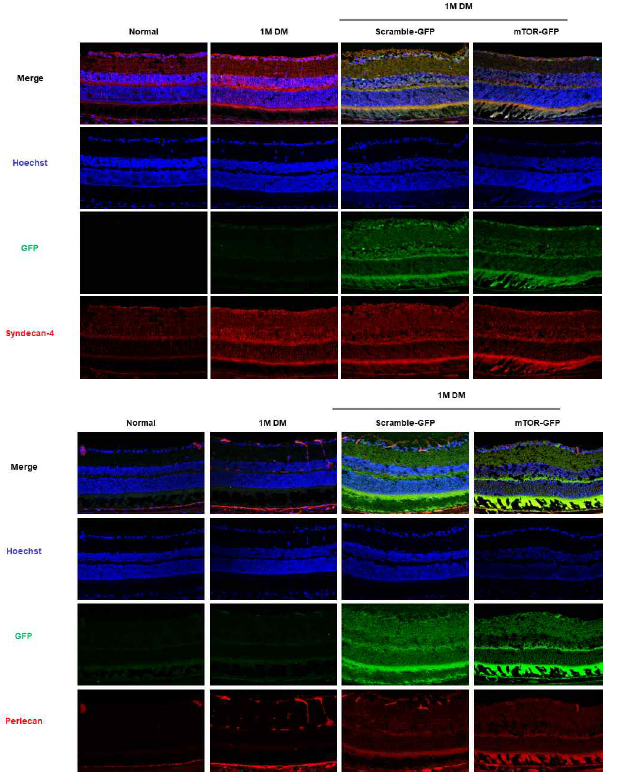 STZ로 유도된 당뇨병성 망막병증에서 AAV2 receptor 인 syndecan-4과 perlecan의 발현과 AAV2-scramble/mTOR shRNA-GFP의 co-localization 확인