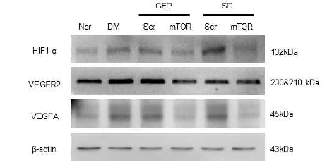 STZ로 유도된 당뇨병성 망막병증에서 mTORshRNA에 의한 HIF1α-VEGF 경로 차단 확인