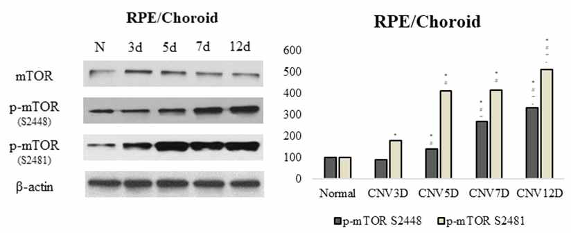 맥락막신생혈관(CNV)에서 total mTOR, p-mTOR(S2448), p-mTOR(S2481)의 시기별 발현 비교 ( 2019년 cell communication and signaling ( impact factor : 5.111 ) 게재됨 )