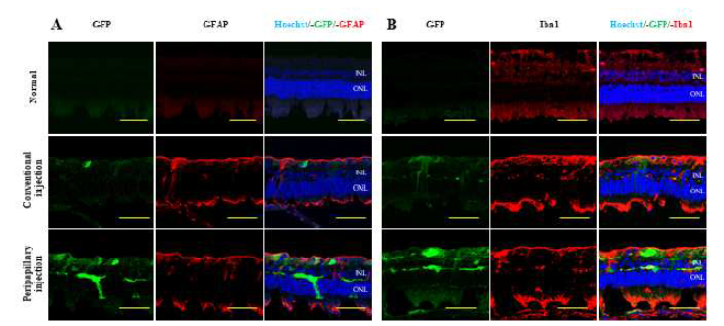 상이한 두 주사법으로 AAV2-eGFP 주사된 망막에서 형질 도입된 glial cell 의 활성화