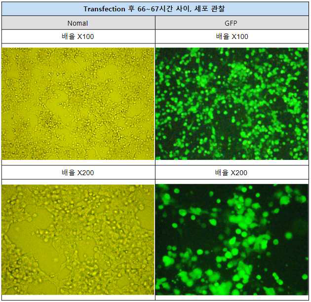 세포 수확 전 관찰한 재조합 AAV2-GFP 벡터를 생산한 세포사진