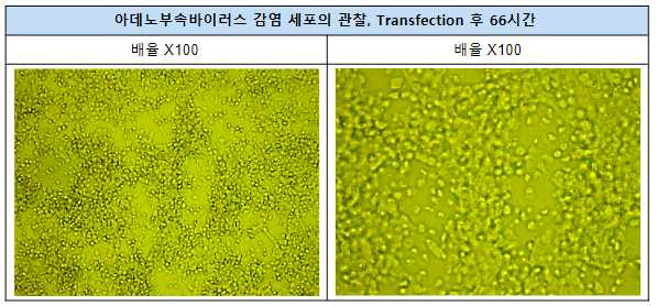 세포 수확 전 관찰한 재조합 AAV 벡터 생산에 따른 세포병변현상 사진