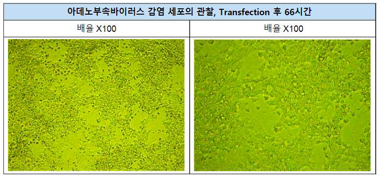 세포 수확 전 재조합 AAV 벡터 생산을 나타내는 세포병변현상 관찰사진