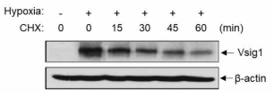 hypoxia에 의한 Vsig1의 단백질 안정화