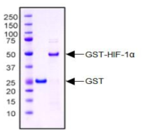 HIF-1α 단백질 정제