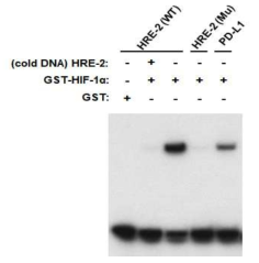 HIF-1α와 HRE의 결합능 gel shift 실험