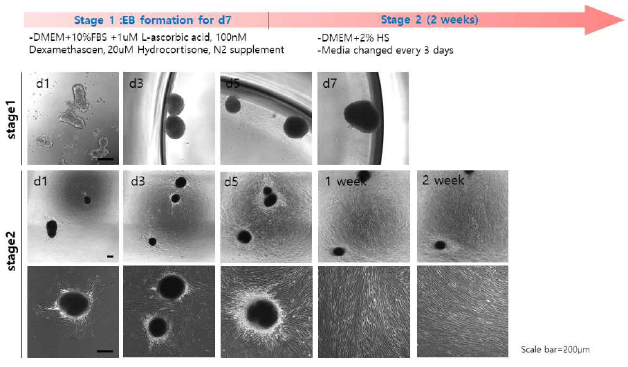 환자유래 편도줄기세포를 분리하고, 분화방법 #2 (DM2 medium)을 사용하여 생체모사 오가노이드 기반 근육세포로의 분화 방법