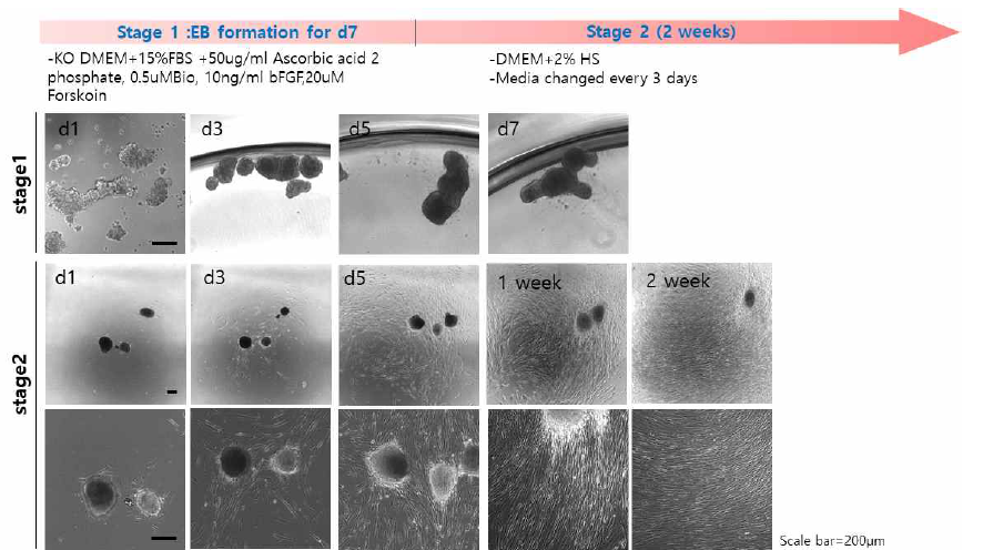 환자유래 편도줄기세포를 분리하고, 분화방법 #3 (DM3 medium)을 사용하여 생체모사 오가노이드 기반 근육세포로의 분화 방법