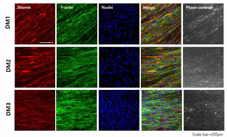 환자유래 편도줄기세포를 활용한 생체모사 오가노이드 기반 근육세포로의 분화 검증 (근육마커: Desmin (적색형광), actin cytoskeleton (초록색 형광))