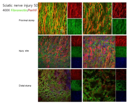 축색 손상 후 Fibronectin과 축색을 동시 염색함. Distal stump에서 Fibronectin이 축색 퇴화후에도 남아있어서 신경과 슈반세포 재생 부위를 제공함