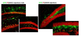 AAV2는 분화된 신경세포와 축색에서 발현하고 AAV8은 증식 중인 NSC와 astrocyte에 도입됨