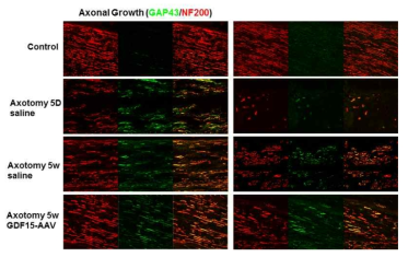 좌골신경손상 5일, 5주 후 axon을 neurofilament heavy chain (NF200), Growing axon을 GAP43항체로 염색함 GDF15-AAV도입군에서 axon이 길게 자람. (GAP43:green, NF200:red)