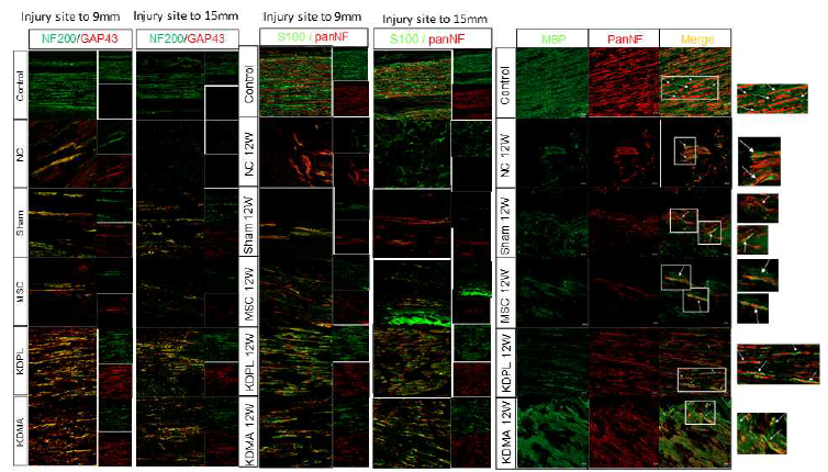 흰쥐 좌골신경 손상 모델 12주 후 axon, Schwann cell, Myelination을 형광염색하고 측정함