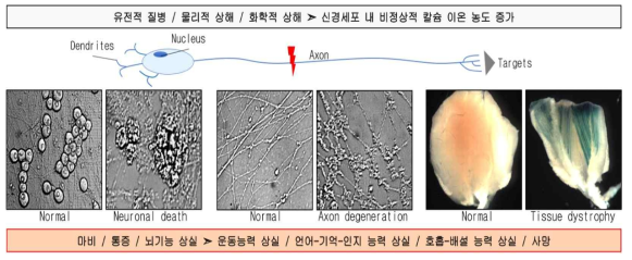 신경퇴행의 원인과 결과. 신경세포는 다양한 요인에 의한 상해를 입을 수 있으며 이 과정에서 비정상적으로 증가한 칼슘이온이 일정시간 내에 정상으로 회복되지 않으면 axon degeneration, neuronal death 그리고 이후 조직위축이 유발됨