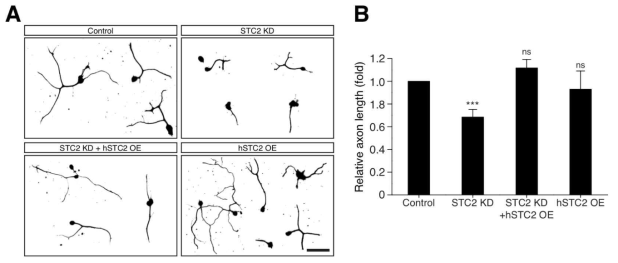 In vitro axon regeneration assay결과. STC2발현을 저해시키기 위해 shRNA lentivirus를 제작하여 STC2 mRNA 양을 억제시키고 in vitro axon injury 및 regeneration을 수행한 결과. A. Control 또는 STC2 knock down, STC2 knock down + human STC2 recovery, human STC2 overexpression의 경우에 따른 신경 재생능 측정 결과. B. 각 조건에 따른 신경 재생능 측정치의 통계 결과. ***P<0.001, ns, not significant