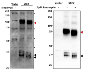 Mammalian cell STC2 분비-system 구축과 SDS-PAGE를 통해 분비된 STC2 단백질의 전기영동상의 이동 패턴 변화 관찰의 반복 실험