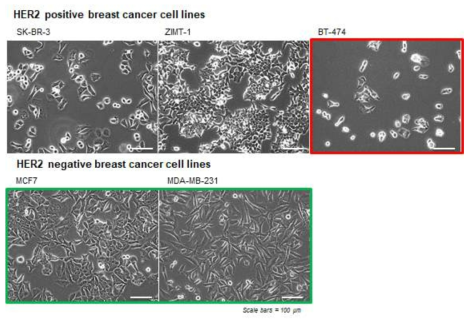 HER2 발현에 따른 5개 유방암 세포주 선정