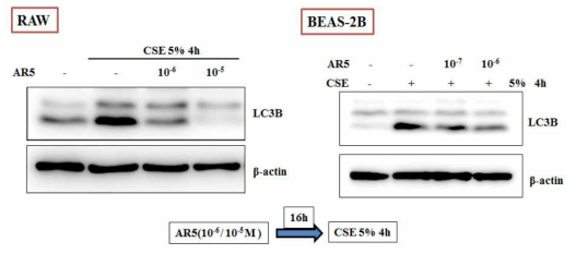 AR5에 의한 autophagy 억제