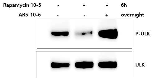 AR5가 ULK1 인산화에 미치는 효과