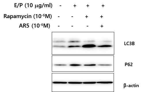 AR5가 autophagy flux에 미치는 효과