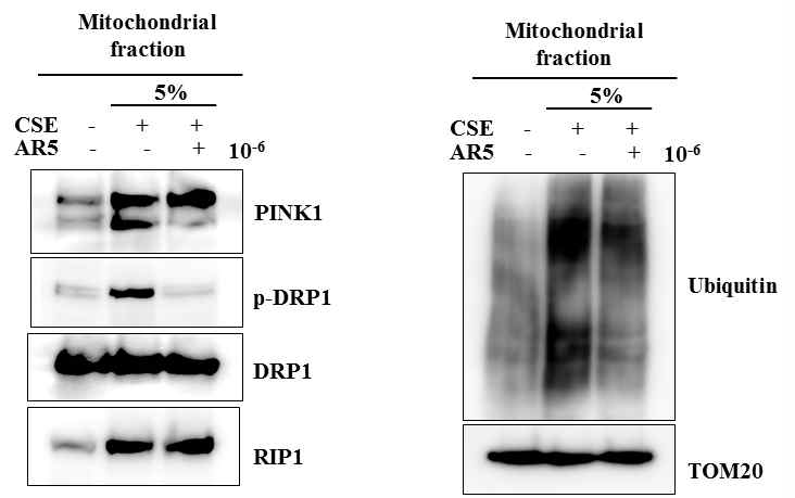 AR5에 의한 mitophagy 억제