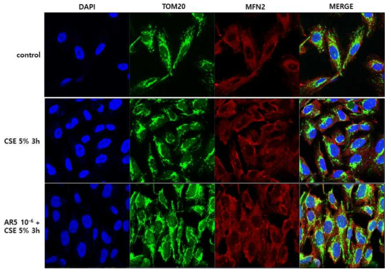 Effect of ABA on MFN2 expression