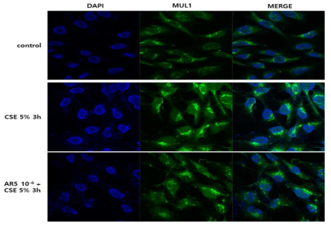 Effect of ABA on MUL1 expression