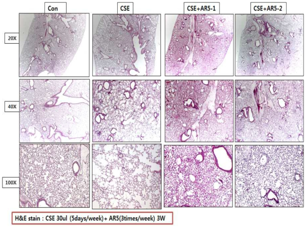 CSE에 의한 COPD 마우스 모델에서 ABA (AR5)의 COPD 억제효과