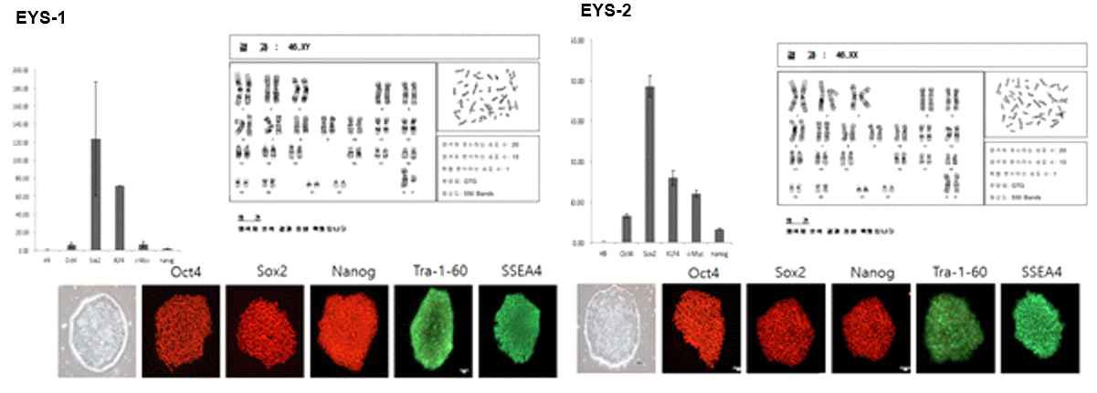 망막 색소변성증 환자 유래로부터 역분화 줄기세포 수립(Karyotype 과 Immunocytochemistry 그리고 qRT-PCR 확인)