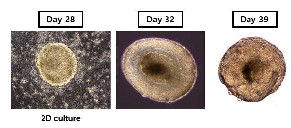 각각 28 일(2D culture), 32일, 39일 째 망막 오가노이드.