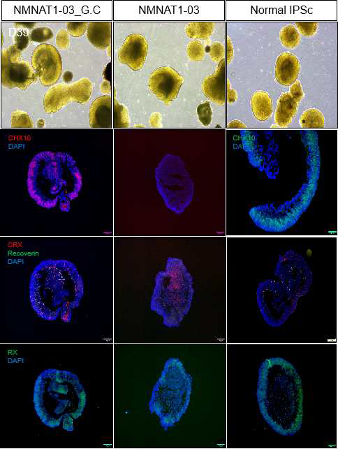 망막 오가노이드 Day 39 일에 IHC 확인한 사진 (unpublished data)