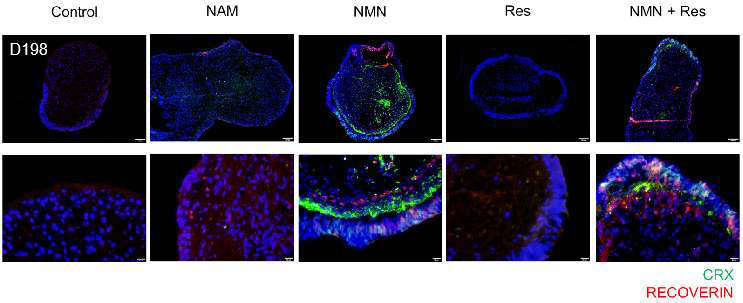 NMNAT01-03 망막 오가노이드에 약물 처리 후 photoreceptor marker CRX 와 Recoverin 을 확인한 사진 (unpublished data)