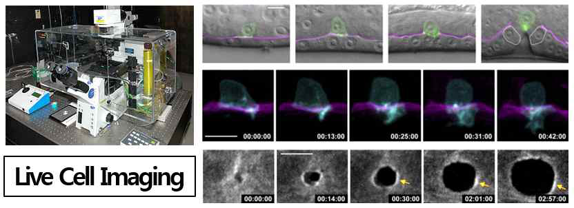 Live cell imaging을 이용한 종양 발달 연구