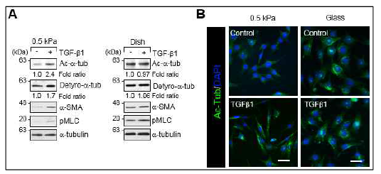 연성환경에서 TGF-β1에 의한 미세소관 수식화 및 섬유아세포 활성 증가 확인