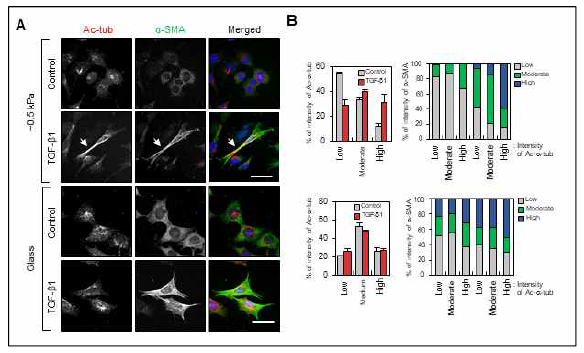 연성환경과 경성환경에서 TGF-β1에 의한 미세소관 아세틸화 증가 및 섬유아세포 활성 관련성 연구