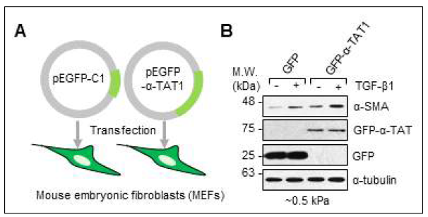 미세소관 아세틸 전이효소 과발현을 통한 TGF- β1에 의한 섬유아세포 활성 확인