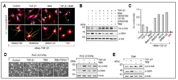 TGF-β1에 의해 활성화되는 kinase의 저해제를 이용하여 미세소관 아세틸화 조절 기작 스크리닝